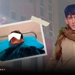 آریان ممندی، کودک کولبر اهل سردشت، یکی از چشم‌های خود را از دست داد